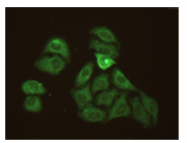 AM09268PU-N - C-reactive protein (CRP)