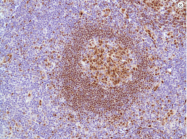 AM09341PU-N - Rhombotin-2