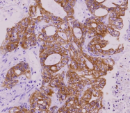 AM09381PU-N - Cytokeratin 18