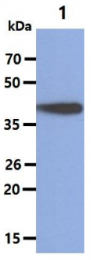 AM09381PU-N - Cytokeratin 18