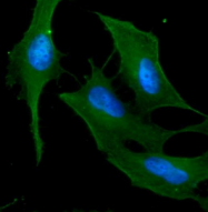 AM09381PU-N - Cytokeratin 18