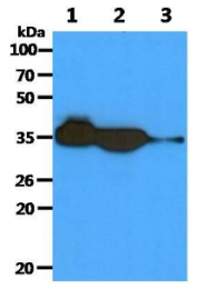 AM09389PU-N - AKR1C1 / DHH1