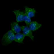 AM09389PU-N - AKR1C1 / DHH1