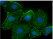 AM09390PU-N - Calsequestrin-2