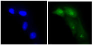 AM09394PU-N - Adenosine kinase