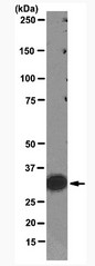 AM10035PU-S - PCNA