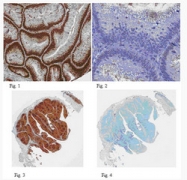 AM10035PU-S - PCNA