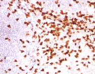 AM10073PU-T - CD8