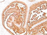 AM10082C3-S - CD227 / Mucin-1 / MUC1