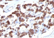 AM10143PU-T - Thyroglobulin
