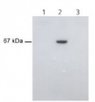 AM10156PU-N - Albumin