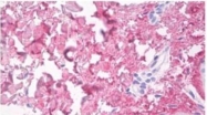 AM10158PU-N - Collagen type V