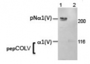 AM10158PU-N - Collagen type V