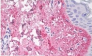 AM10159PU-N - Collagen type V