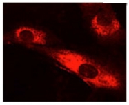 AM10159PU-N - Collagen type V