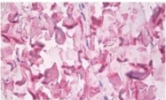 AM10160PU-N - Collagen type V