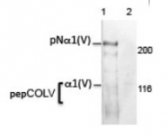 AM10160PU-N - Collagen type V