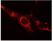 AM10160PU-N - Collagen type V