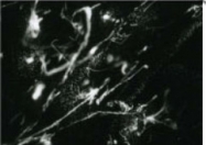 AM10160PU-N - Collagen type V
