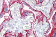 AM10193PU-N - CD46 / MCP
