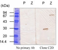 AM10225PU-N - Transglutaminase-3 (TGM3)