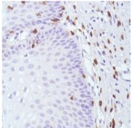 AM11118PU-S - CD8