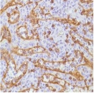 AM11118PU-S - CD8