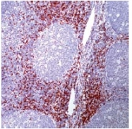 AM11118PU-S - CD8