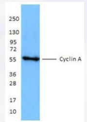 AM20281PU-S - Cyclin A2