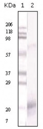 AM20853PU-N - IFNG / Interferon gamma