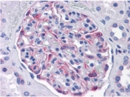 AM21005PU-N - SLC44A2 / CTL2