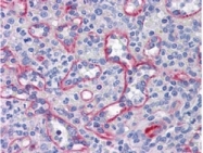 AM21005PU-N - SLC44A2 / CTL2