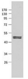 AM21054PU-T - Ataxin-3
