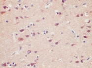 AM21054PU-N - Ataxin-3