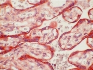 AM21054PU-N - Ataxin-3