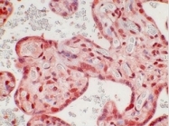 AM21054PU-N - Ataxin-3