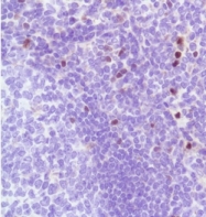 AM21067PU-M - FOXP3