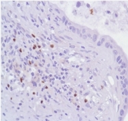 AM21067PU-M - FOXP3