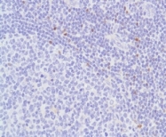 AM21067PU-M - FOXP3