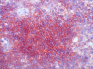 AM26052BT-N - CD3