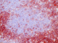 AM26053BT-N - CD4