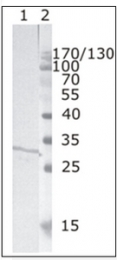 AM26074PU-N - HIV-1