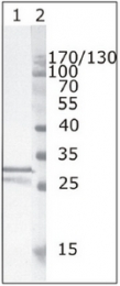 AM26075PU-N - HIV-1