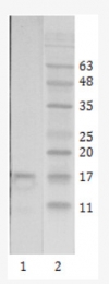 AM26084PU-N - HIV-1