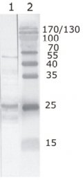 AM26085PU-N - HIV-1