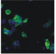 AM26089PU-N - HIV-1