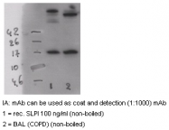 AM26282BT-N - Antileukoproteinase / ALP