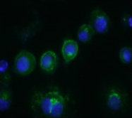 AM26319FC-N - CD14