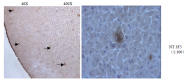 AM26395PU-L - Amyloid beta