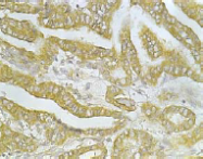 AM26442SU-L - CD26 / DPP4